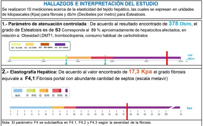 Elastografía hepática_001