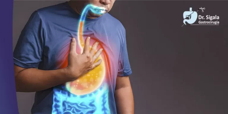 Enfermedad por Reflujo Gastroesofágico